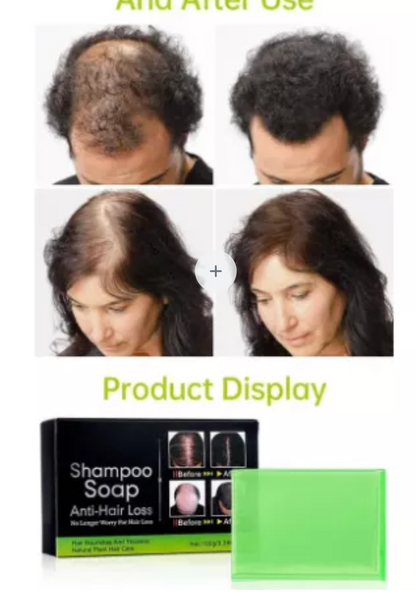 Dile adíos a la caída del pelo con nuestro jabón en barra terapéutico